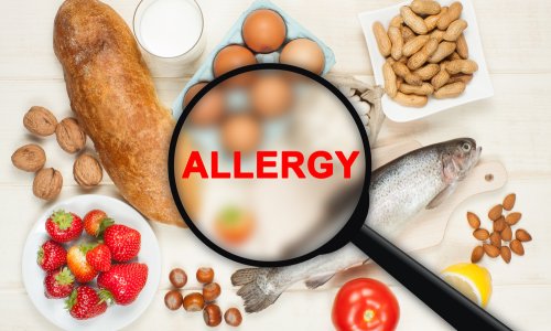 Apa itu alergi ?