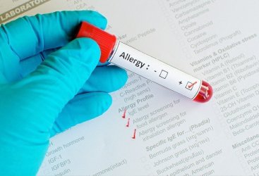 Apakah Mungkin Penyakit Alergi pada Anak Bisa Sembuh Total?