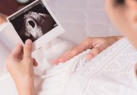 Proses Perkembangan Janin pada Kehamilan Minggu Ke-9