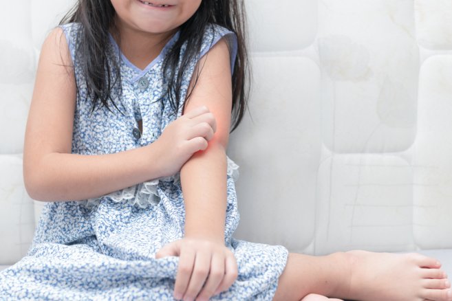 Bunda, Ini 5 Cara Mengatasi Alergi Susu Sapi pada si Kecil