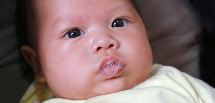 Penyebab Bayi Sering Gumoh dan Cara Mengatasinya