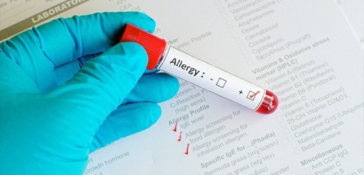 Mungkinkah Alergi Disembuhkan?