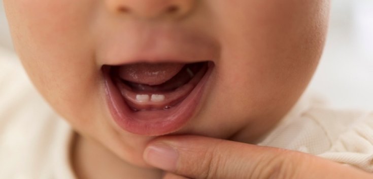 Cek! Ini Tahapan Pertumbuhan Gigi Bayi yang Perlu Bunda Ketahui