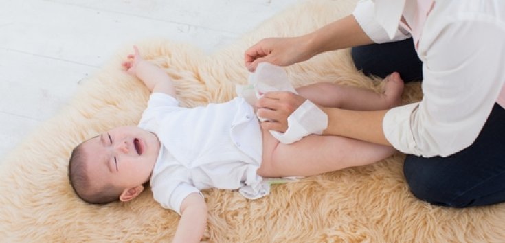 Penyebab Ruam Popok Bayi, Ciri-Ciri, dan Cara Mengatasinya