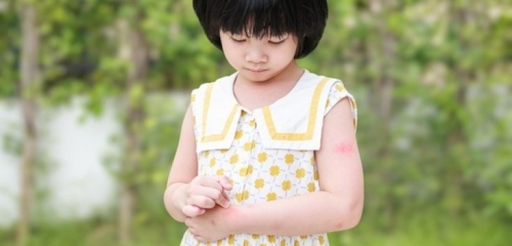 10 Cara Mengatasi Dampak Psikologi Anak Alergi 